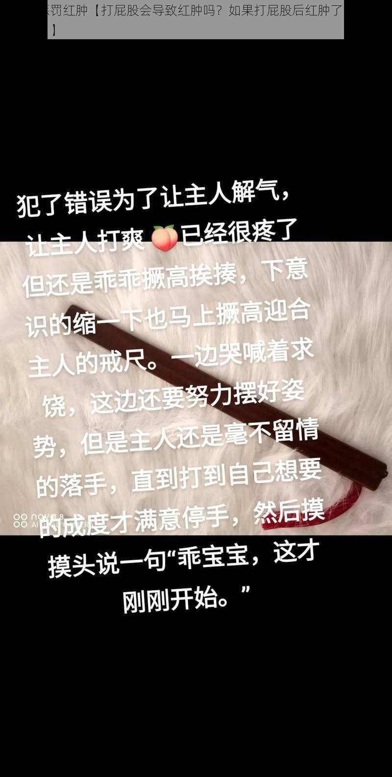 撅该打惩罚红肿【打屁股会导致红肿吗？如果打屁股后红肿了，应该怎么处理？】